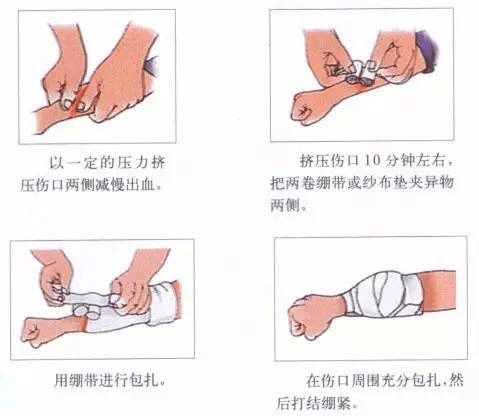 家庭急救指南，切割傷的止血與急救技巧