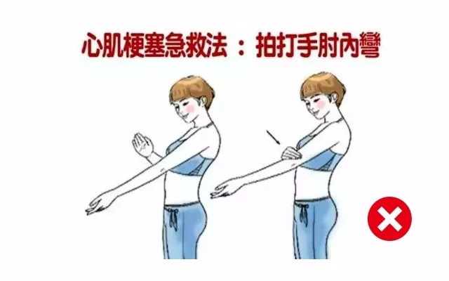 急救操作常見(jiàn)錯(cuò)誤分析及避免策略