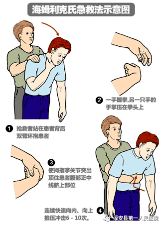 孩子窒息急救步驟與方法指南