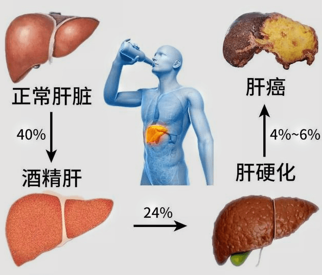 中醫(yī)肝臟調(diào)理與壓力緩解之道